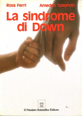 La sindrome di Down